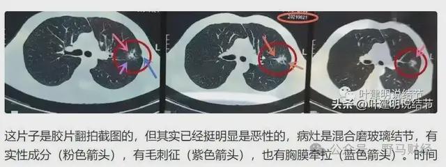 爱康国宾二次声明“漏癌”无责,女律师发出7大灵魂拷问! 爱康国宾二次声明“漏癌”无责,女律师发出7大灵魂拷问!