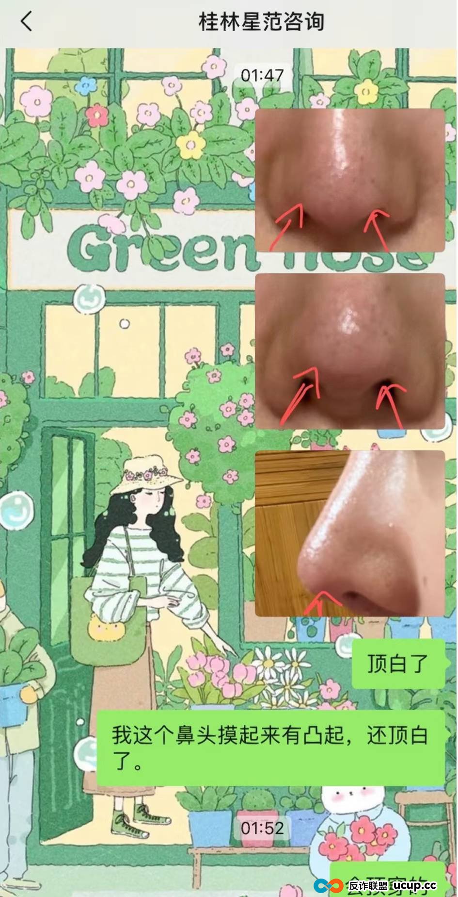 被曝用异体骨隆鼻之后，桂林星范整形如何重建消费者信任？