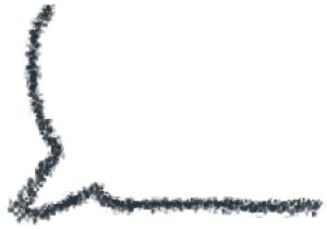 79岁特朗普罕见自曝!手上瘀伤是过量服用阿司匹林造成 79岁特朗普罕见自曝!手上瘀伤是过量服用阿司匹林造成