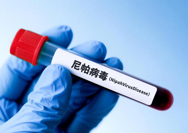 印度尼帕病毒拉响警报，尚无疫苗和有效疗法，检测试剂盒受关注，多家上市公司回应